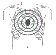 胸骨圧迫の位置